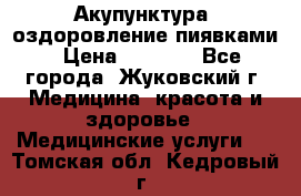 Акупунктура, оздоровление пиявками › Цена ­ 3 000 - Все города, Жуковский г. Медицина, красота и здоровье » Медицинские услуги   . Томская обл.,Кедровый г.